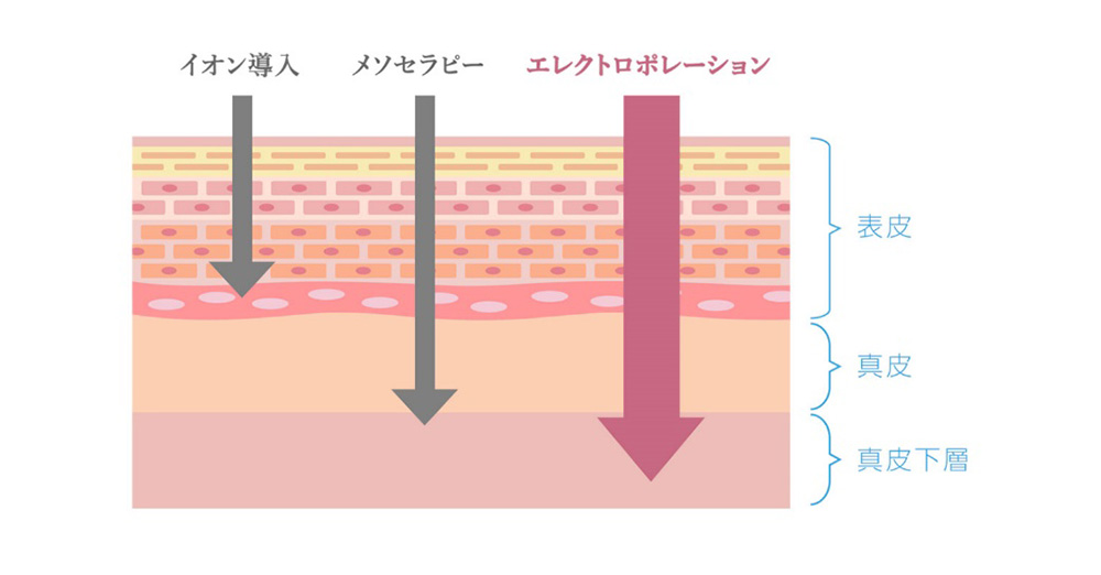 エレクトロポーションSpring